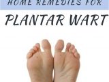 Home Remedies for Family Planning How to Get Rid Of Plantar Warts Plantar Warts Treatment